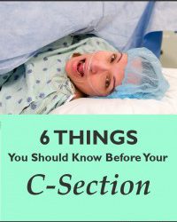 6 Things You Should Know Before Your C-Section
